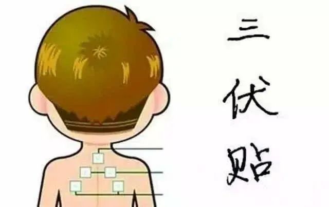 1、“儿童三伏贴”能让孩子少生病吗？爸爸妈妈不再盲目跟风了。